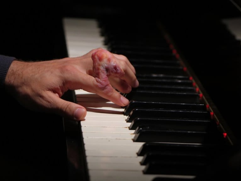 musician s finger injury condition